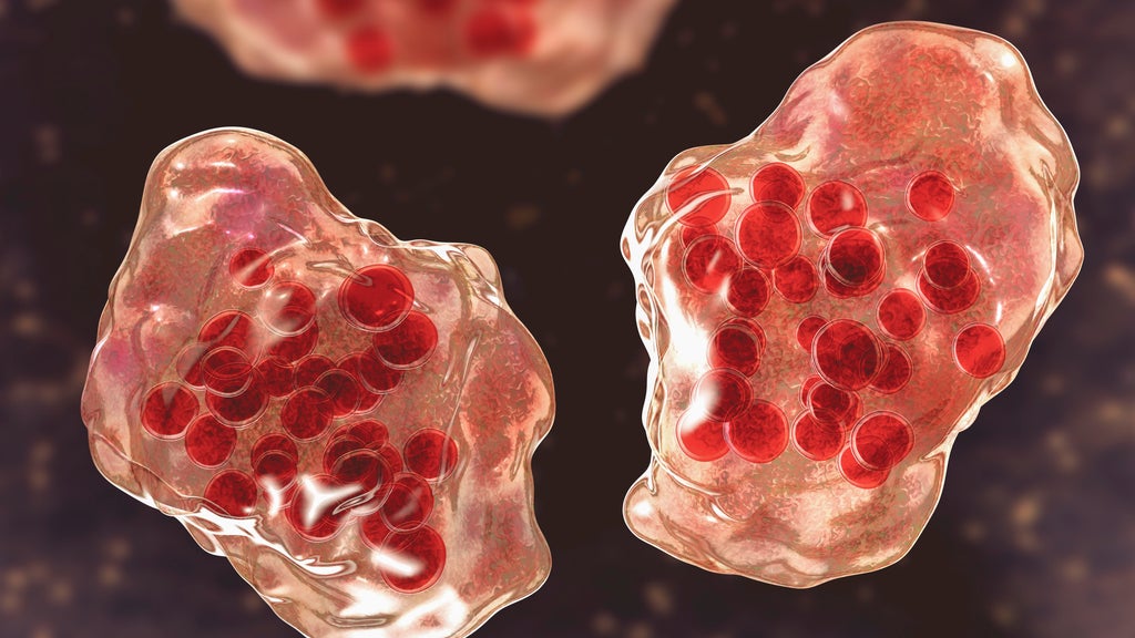Central Minnesota county reports "several cases of suspected measles" — WCCO / CBS Minnesota, Eagan Health news