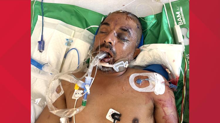 University Hospital asks for help identifying unconscious patient hit by truck Saturday evening — KENS 5 (San Antonio), Eagan Health news