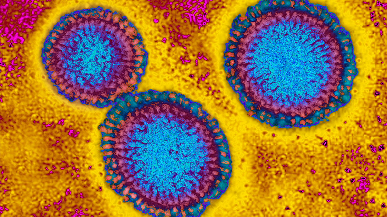 Flu hospitalizations 'slightly higher' than usual, officials urge vaccinations — FOX 9, Eagan Health news